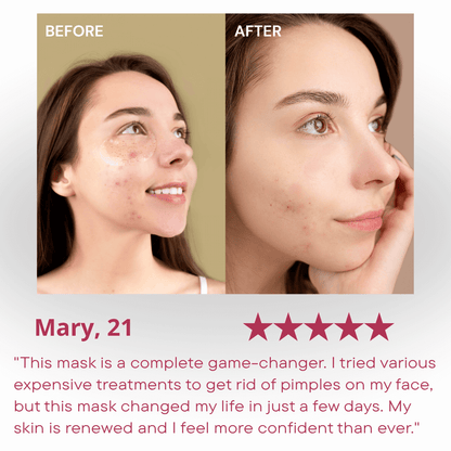 LED Light Therapy Face Mask for Anti-Aging & Acne | Glamiway